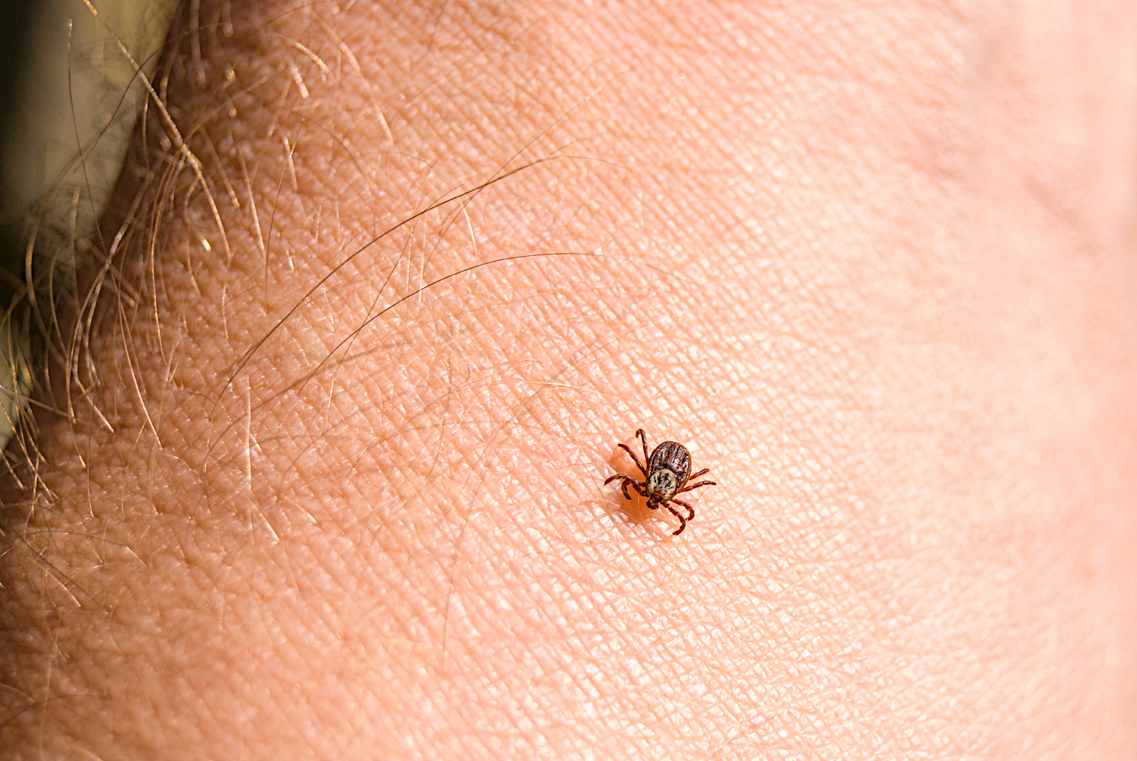 What is Mammalian Meat Allergy?